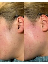 ミオワックス(MIOWAX)/成人式のご準備