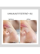 ポムハヌル(pom.haneul)/韓国肌管理室