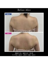 サロンドベル(salon de Belle)/20分の効果