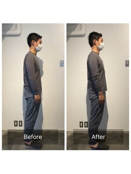 美容整体プラスフィール 恵比寿本店/姿勢矯正・猫背改善