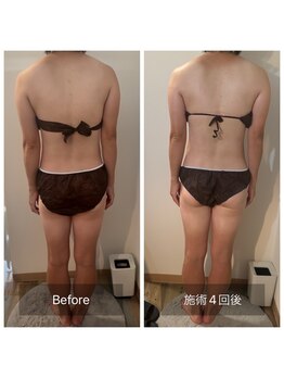 フィエルテ 甲斐敷島(FIERTE)/お客様 Before After