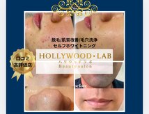ハリウッドラボ 板垣店(HOLLYWOOD LAB)