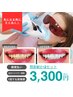 《新規限定》1回で即実感!!かなり白くなる!!セルフホワイトニング ￥3,300