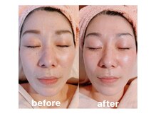 エステティックルーム マイサロン(mysalon.)/お肌のくすみを飛ばして透明感
