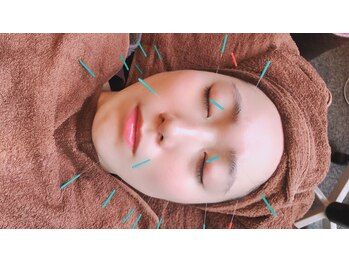 レメディ/再生美容鍼コース（ヒト幹導入）