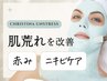 肌荒れ/赤みケア【荒れた肌を素早く鎮静】乳酸菌ピーリング/クリスティーナ