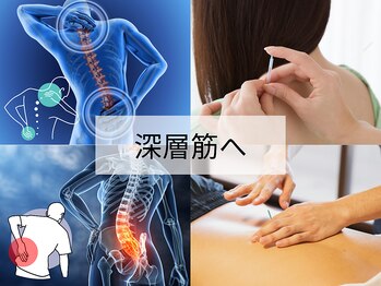 たか鍼灸接骨院