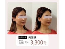 コガオ レンネ(Lenne)