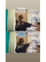 西宮ヤノ整骨院/50代女性痛みで上げられない肩が