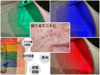 ラシュシュ(La chou chou)の写真/【大人気★プラズマフェイシャル】様々な悩みに肌の土台から整え解決する肌質改善メニュー!ニキビケアに◎