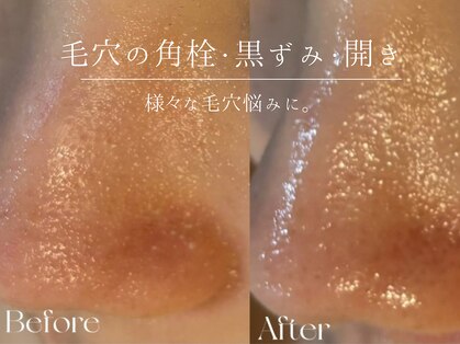 ウィハナ(wehana)の写真
