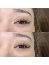 リス 播磨店(Lys)/バインドロック