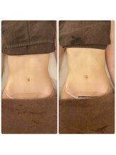 森の時計/症例写真:ウエスト編