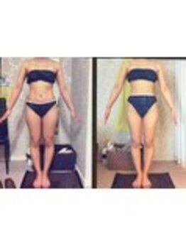 パーフェクトボディプレミアム 渋谷店(PERFECT BODY PREMIUM)/お客様 ビフォーアフター(12)