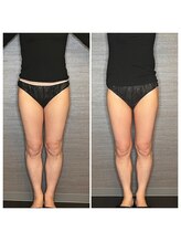 マハロ ザ ビューティー(mahalo the beauty)/痩身