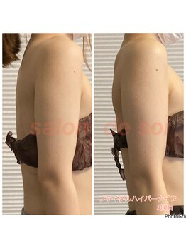 サロン ド ソワ(salon de soi)/ブライダル