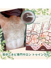 プライベートエステサロン トゥインクル/ハーブ導入後はしっかり鎮静ケア