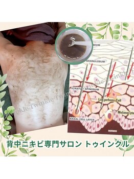 プライベートエステサロン トゥインクル/ハーブ導入後はしっかり鎮静ケア