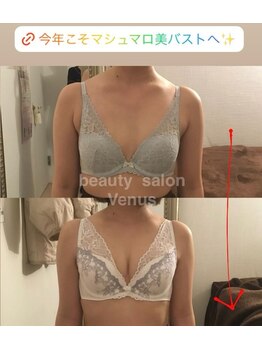 ヴィーナス(Venus)/バストアップ(痩身効果◎整体◎