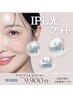 【美白シミケア】IPL光フォトダブル＋肌質改善パック付　