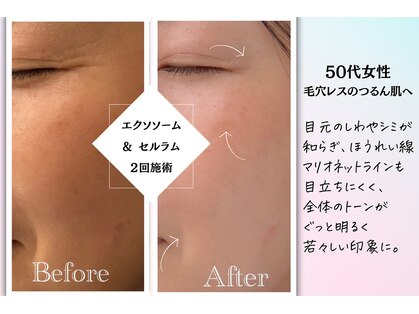 サロン ド エム(salon de m)の写真