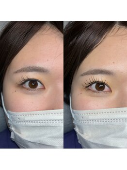 フィグ(fig)/ラッシュリフト