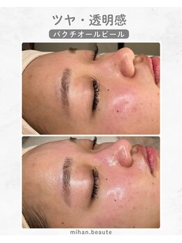 ミハン ボーテ(mihan.beaute)/