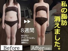 セレブリボーン 大阪ボーテ