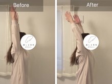 一度で変化を実感、さらに定期的なケアが大事