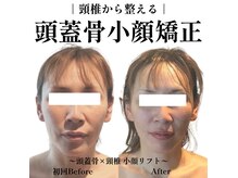 マルウル(maluulu)