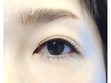 ポポミール(POPOMEEL)/レーザーラッシュ160本