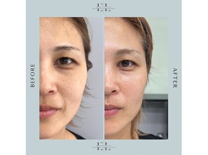 ホワイトラボ 姫路(White labo)の写真