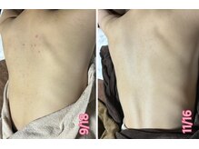 エステサロン ピリナ(pilina)の雰囲気（日本最高峰ハーブピーリングローズドメーラで結果出し◎実績10年）