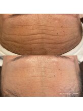 エクラ(eclat)/クリスティーナ