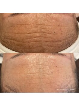 エクラ(eclat)/クリスティーナ