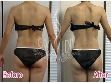 グラウディア 恵比寿/痩身/筋膜リリース/インディバ超