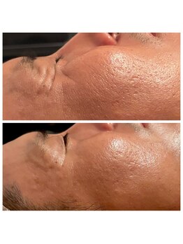 エヌア(nA)/ビフォーアフタービオフィート♪