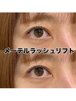 レディエント 北浦和店(Radiant)/メーテルラッシュリフト