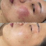 リリードボーテ 高槻店(LILY DE BEAUTE)