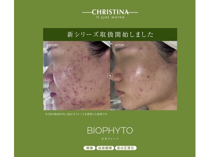 ソルカナ(Solkana)の写真