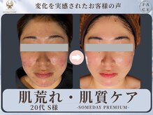 サムデイ プレミアム 池袋店(SOMEDAY PREMIUM)/FACE