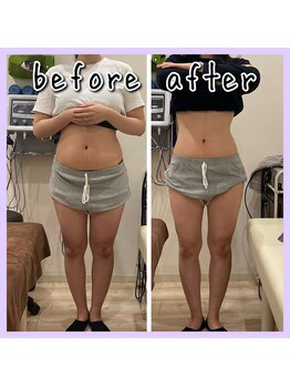 昭和区川名ひまわり接骨院/産後骨盤矯正×ダイエット【2】