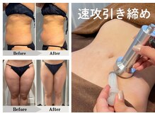 エミット(emit.)の雰囲気（二の腕・お腹・脚。気になる部分を速攻引き締め！）