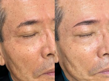 クラッシーブロウ 浦添/HBL[エイチビーエル]