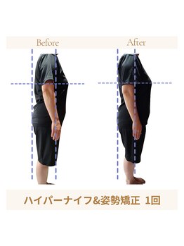 コリ チル(Kori Chill)/【ハイパーナイフと姿勢矯正】