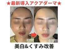 ルルアス(LuLu AS)