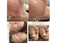 セルヴィノバ(CELL VI NOVA)