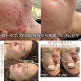 セルヴィノバ(CELL VI NOVA)