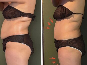 マヨズサロン(Mayo’s salon)/贅沢フルボディーケア