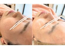 初回から驚きのトーンアップ艶肌に★